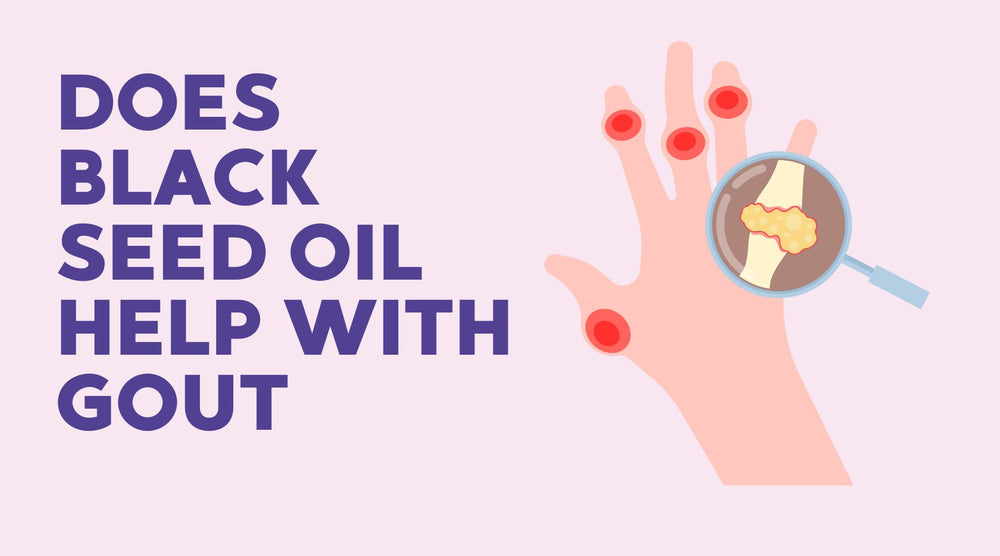 Does Black Seed Oil Help With Gout