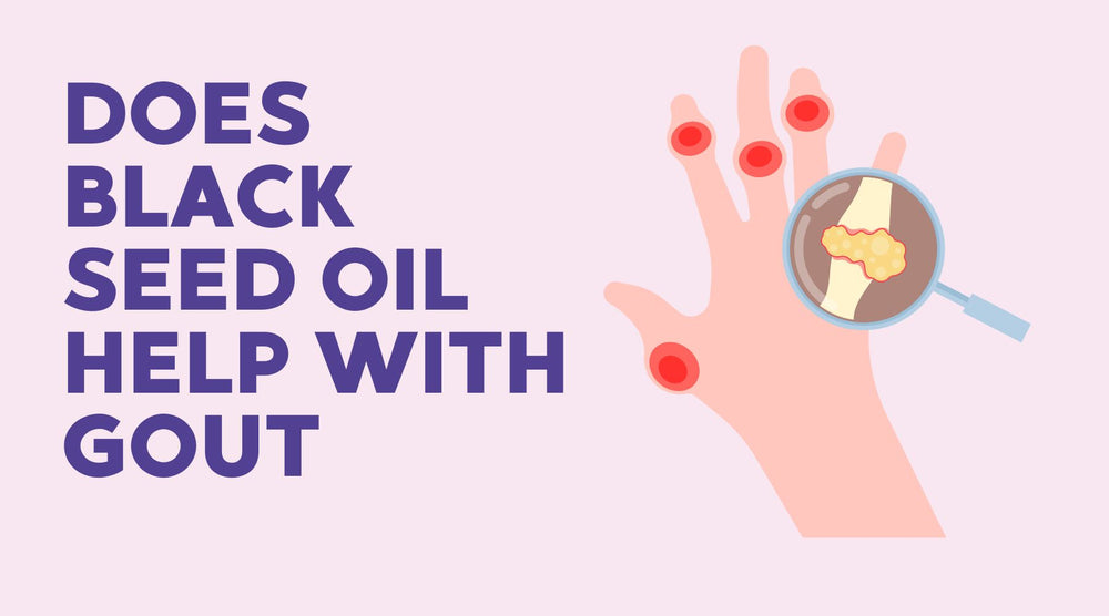 Does Black Seed Oil Help With Gout? Benefits Explained