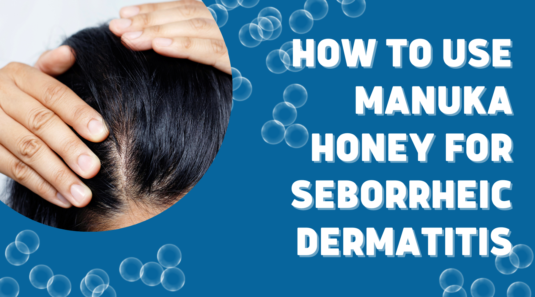 How To Use Manuka Honey For Seborrheic Dermatitis Nature s Blends how-to-use-manuka-honey-for-seborrheic-dermatitis-nature-s-blends