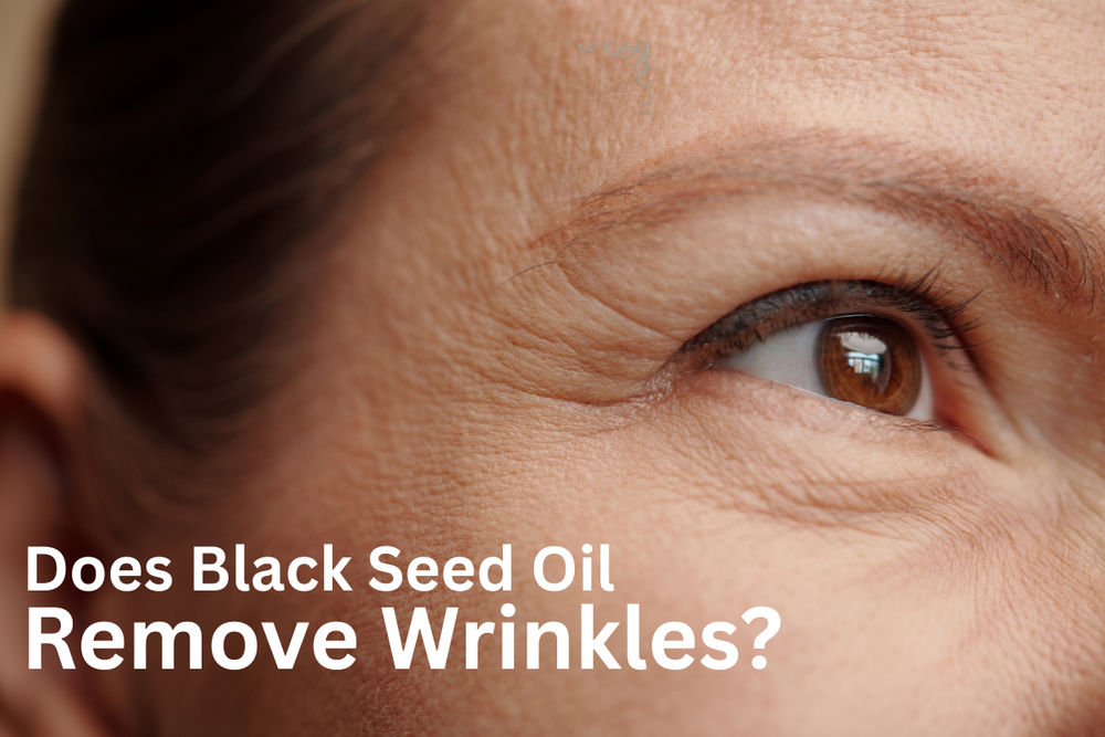 Does Black Seed Oil Remove Wrinkles