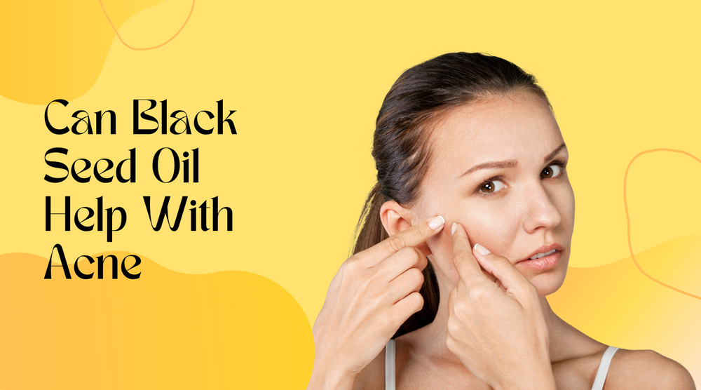 Can Black Seed Oil Help With Acne