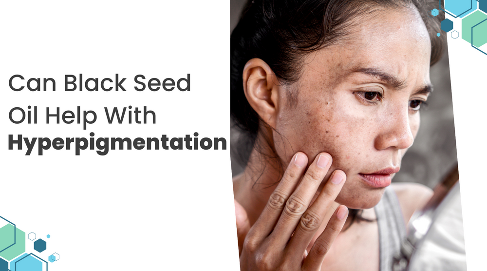 Can Black Seed Oil Help With Hyperpigmentation