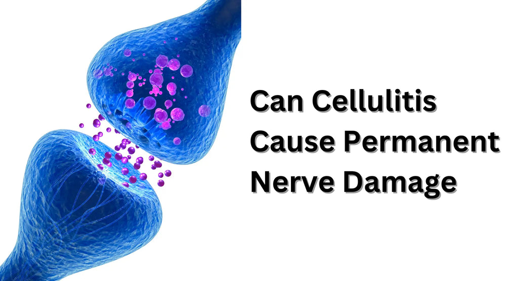 Can Cellulitis Cause Permanent Nerve Damage?