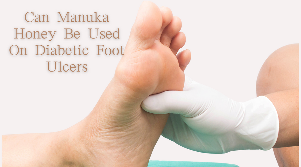 Can Manuka Honey Be Used On Diabetic Foot Ulcers