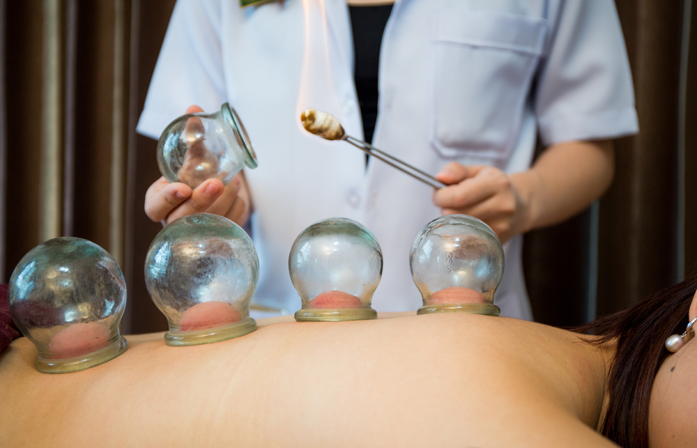 What Does Cupping Do for Athletes? | Cupping Benefits for Athletes