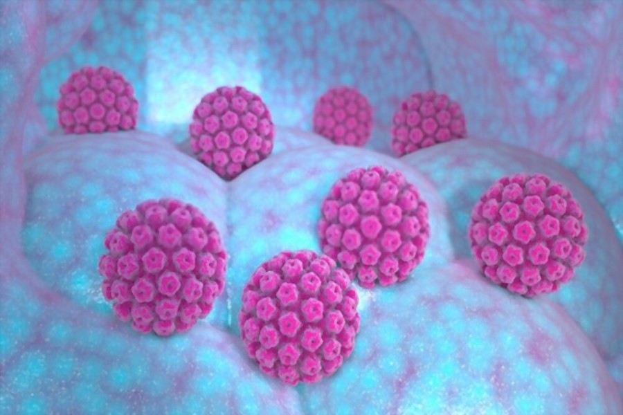 HPV - Symptoms and its Treatment